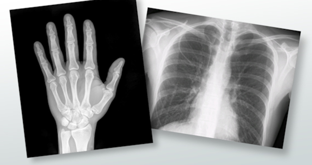 Radiology Imaging